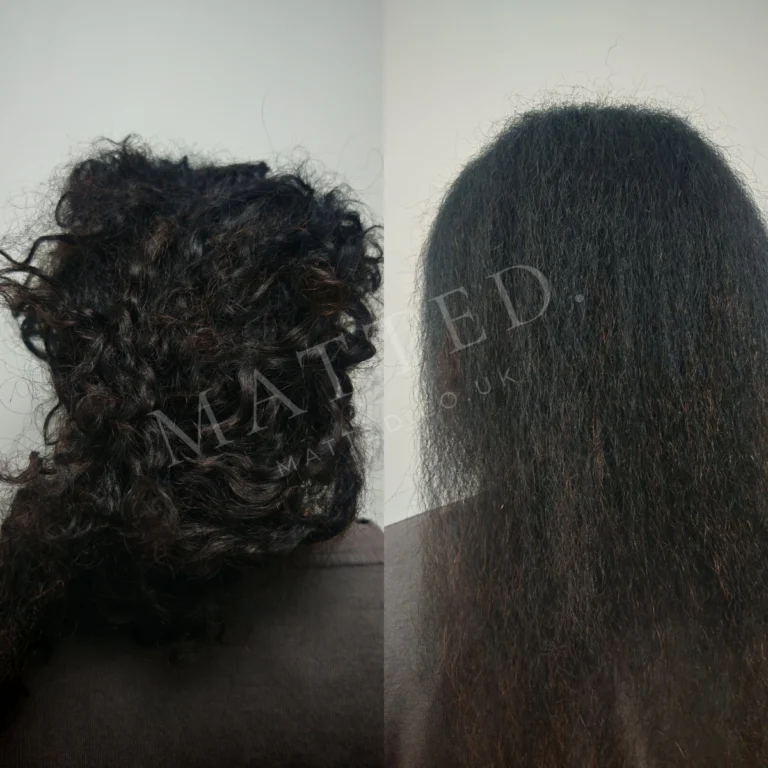 Curly hair matted during a depressive episode, opened without cutting or shaving