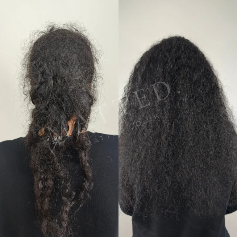 Curly hair matted after a hospital stay, restored without cutting