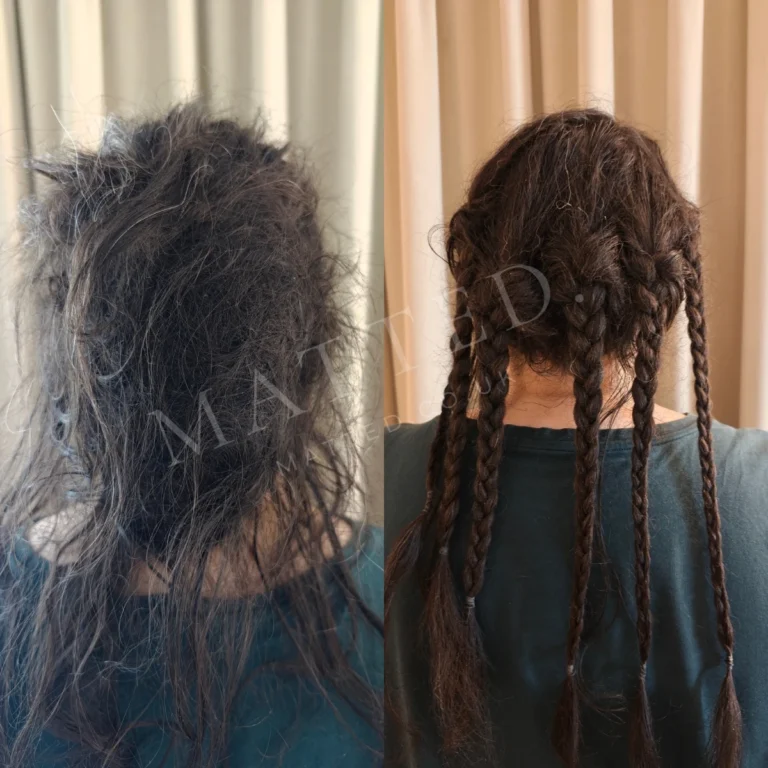 Wavy hair matted after a hospital stay, opened and returned at full length