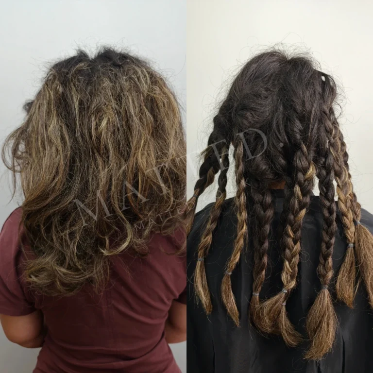Severely matted straight hair combed clear without scissors