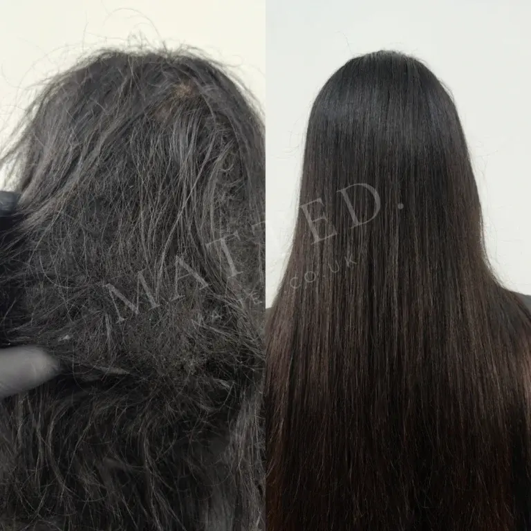 Severely matted straight hair cleared while keeping every centimetre of length