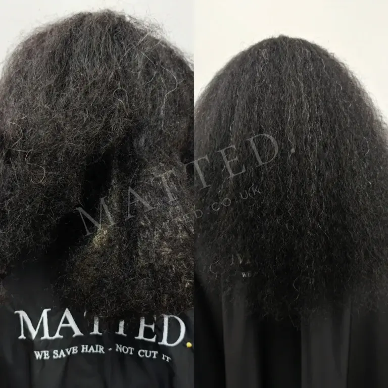 Wavy hair matted during a hospital stay, opened with no pressure on the scalp