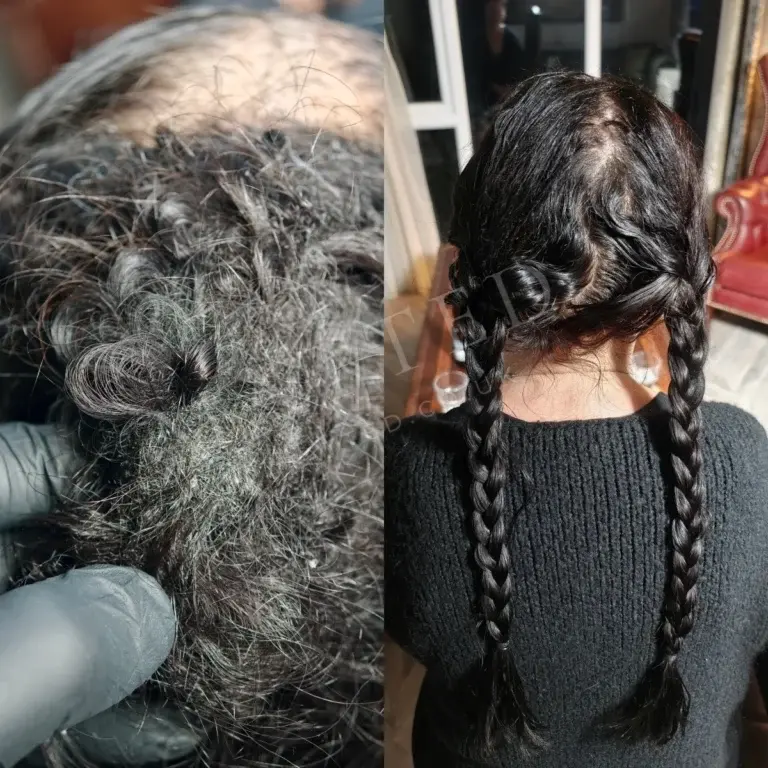 Severely matted straight hair before and after, treated with no rush