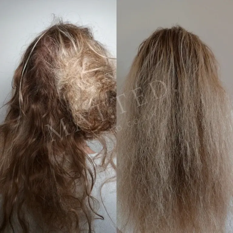 Severely matted straight hair restored to full length in the London studio