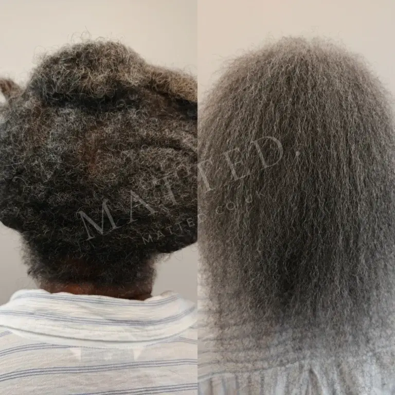 Matted curly hair opened without heat, chemicals or cutting