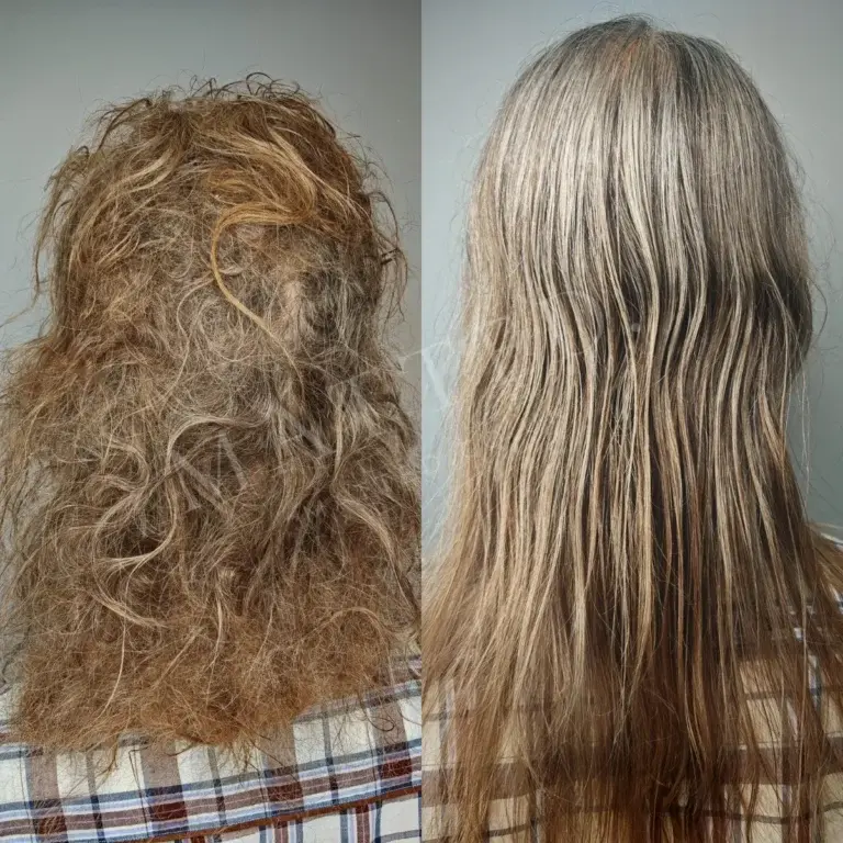Severely matted straight hair cleared in one uninterrupted appointment